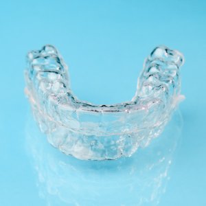 3 Common Questions About Invisalign in San Bernardino