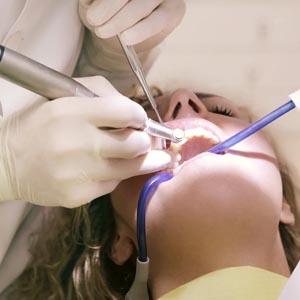 4 Common Procedure by Oral Surgeon