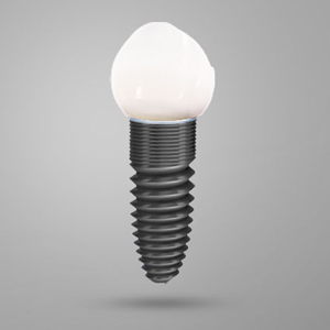 Remedies for Missing Teeth | Dental Implants San Bernardino