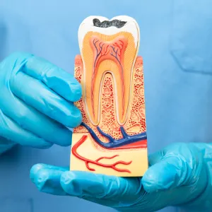 Signs You Need Root Canal Treatment in San Bernardino