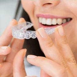 Top 5 Benefits of Choosing Invisalign in San Bernardino