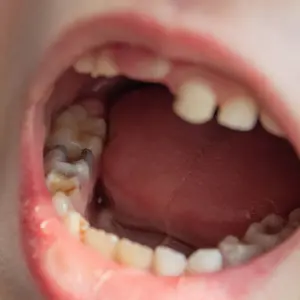 Helpful dental information about children dentistry San Bernardino